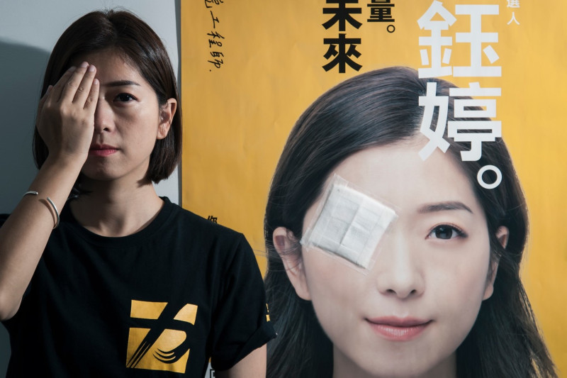 時代力量新竹市立委參選人高鈺婷今(22)日在臉書貼出遮右眼照，響應「Eye For Hong Kong」，挺香港反送中行動。   圖：翻攝自高鈺婷臉書