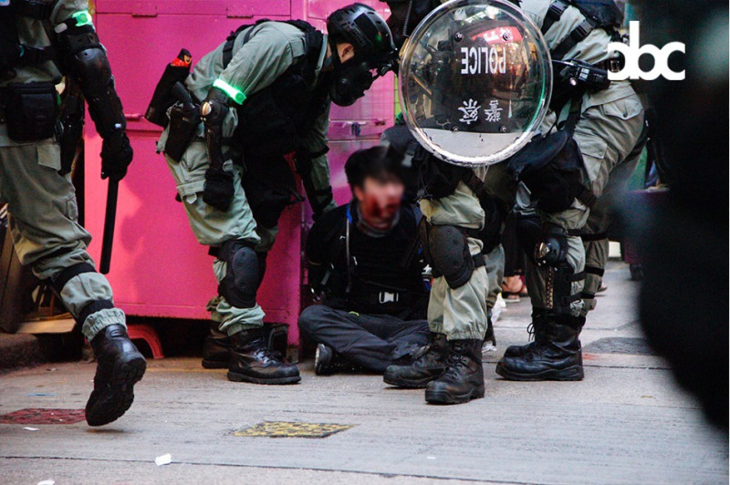 港島遊行，示威者與警方在金鐘夏愨道爆發衝突，一年青人遭警方逮捕，衝突過程中受傷。   圖：翻攝自城市廣播臉書。