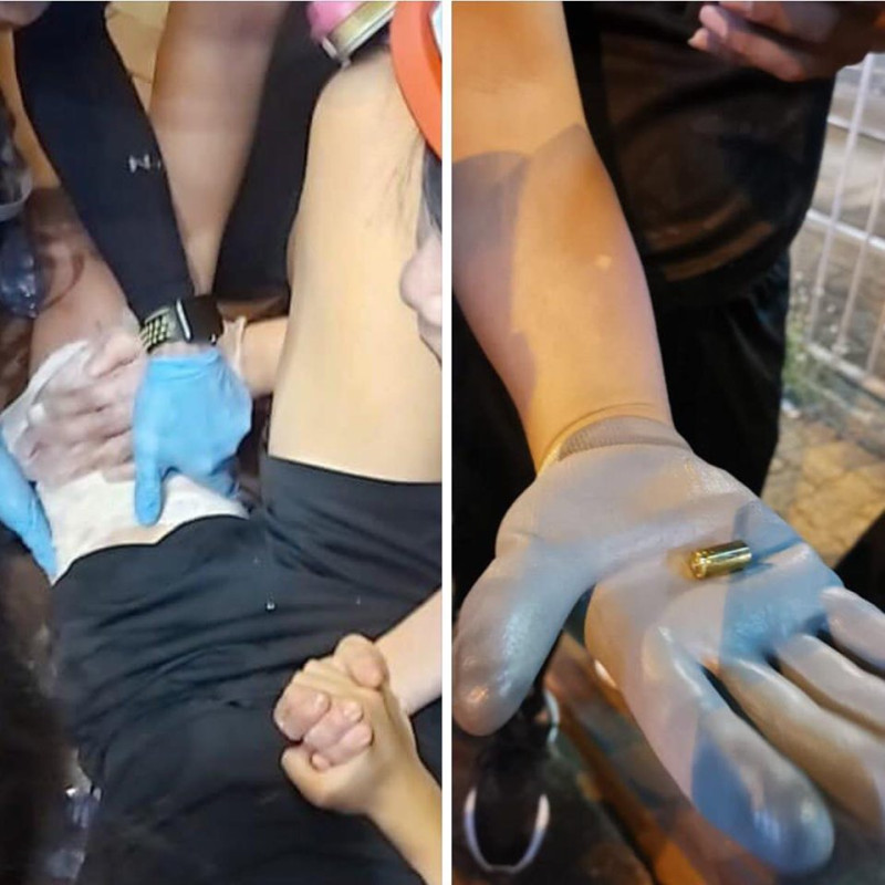 元朗14歲示威者大腿疑中實彈受傷 現場遺彈殻。   圖：翻攝星島網
