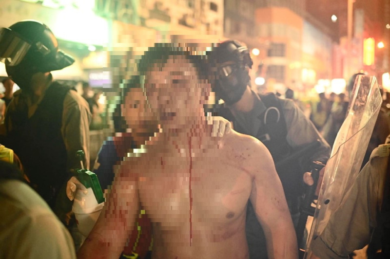 香港1013暴發嚴重警民衝突，有人被打到頭破血流。   圖：翻攝StandNews立場新聞