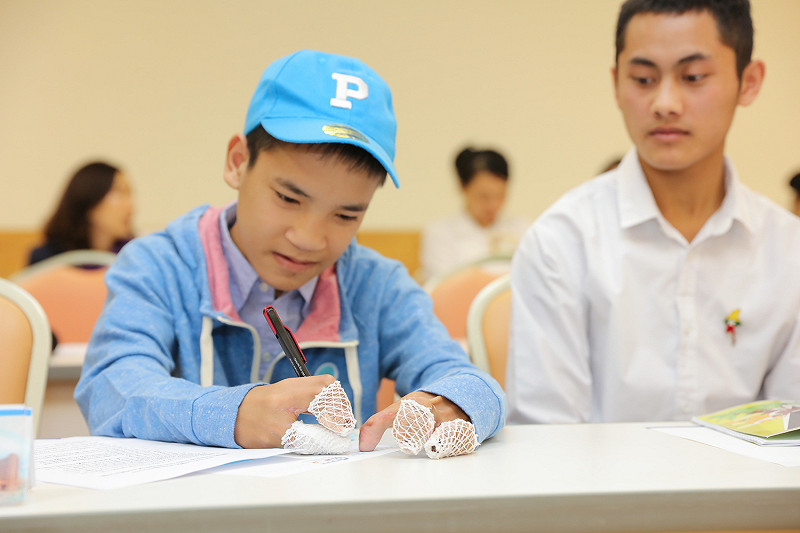 新光醫院促成台緬鴨掌手醫衛計畫，幫助緬甸少年執行手指分離手術。    圖／新光醫院提供
