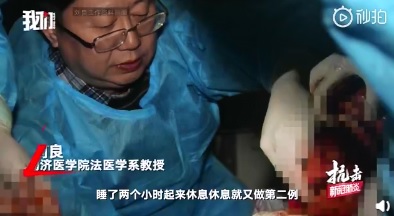 中國針對武漢肺炎死者進行遺體採樣，由同濟醫學院法醫學系教授劉良16日連續解剖2具遺體。   圖：翻攝自中國微博影片