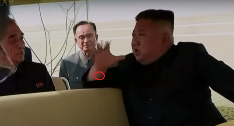 朝鮮當局前天放出的影片中，金正恩手上似乎有一道新的疤痕。   圖：朝鮮國營媒體機構朝鮮中央新聞社影片截圖