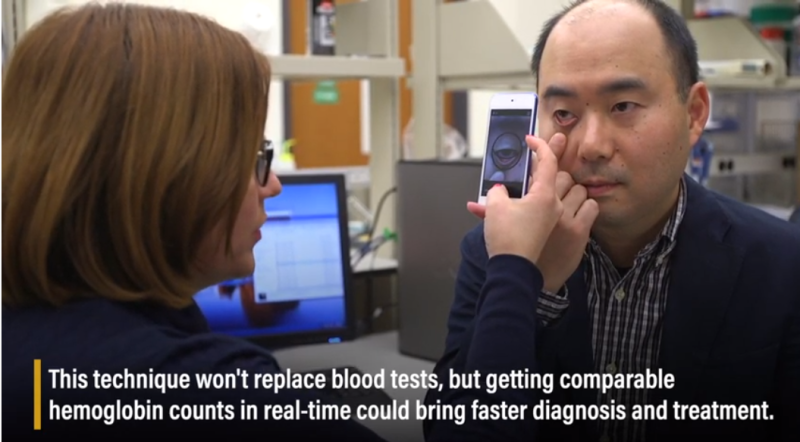 美國普度大學研究團隊藉開發該技術，協助醫生診斷貧血症狀。   圖：擷取自Purdue University官網
