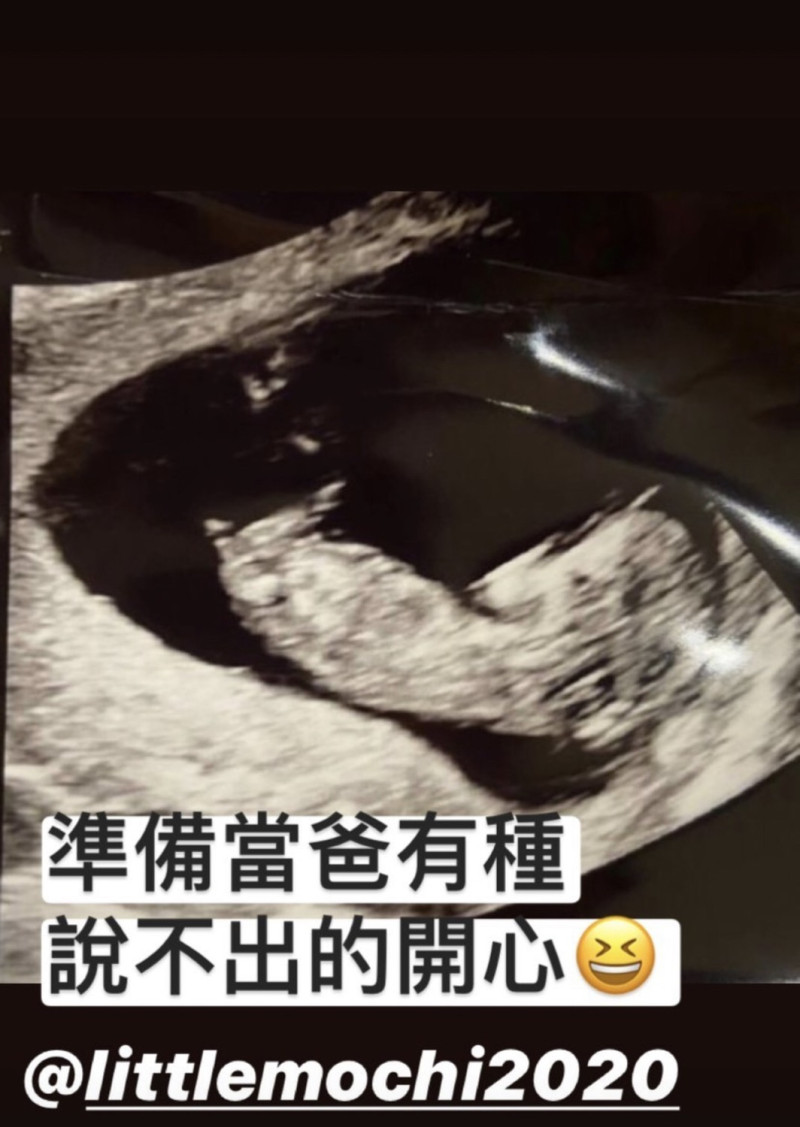 馬叔叔公佈小孩超音波照片。   圖：翻攝Instagram