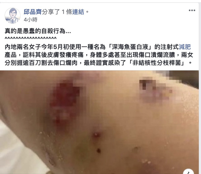 兩名中國女子使用免費減肥產品「深海鱘魚蛋白液」後竟感染非結核分枝桿菌，對此皮膚科醫生邱品齊表示：「真的是愚蠢的自殺行為……」   圖：翻攝自邱品齊臉書