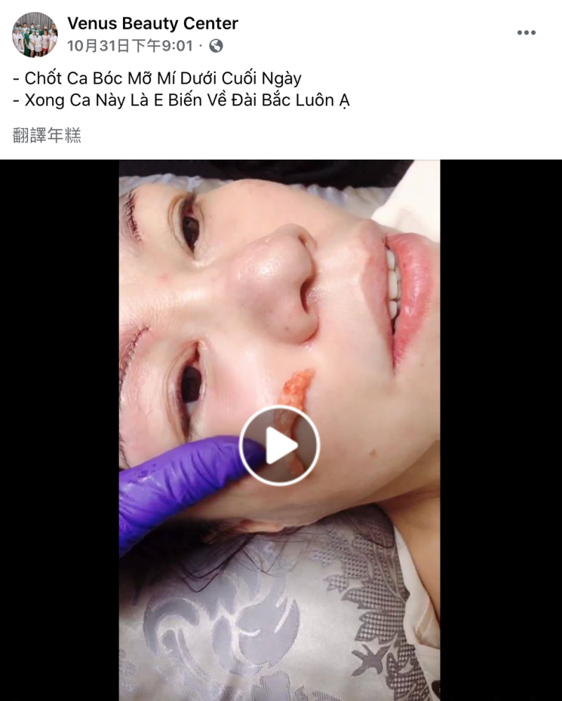 1名越南籍25歲鄭姓女移工，於桃園以醫美專家身分從事豐唇、割雙眼皮等各種醫美微整型手術，並大膽透過臉書直播手術過程。   圖：翻攝自Venus Beauty Center 粉絲專頁