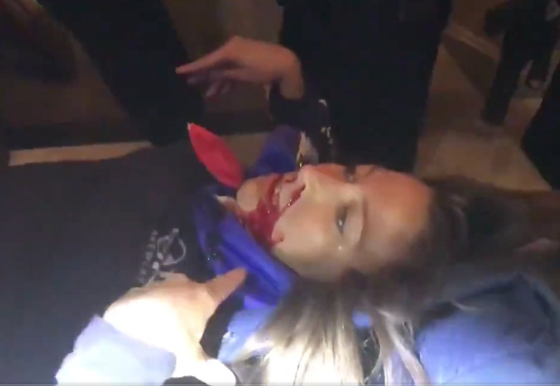 芭比特（Ashli​​ Babbit）在今日的美國國會大廈暴動中胸口中彈身亡，口冒大量鮮血。 圖：取自@TaylerUSA推特