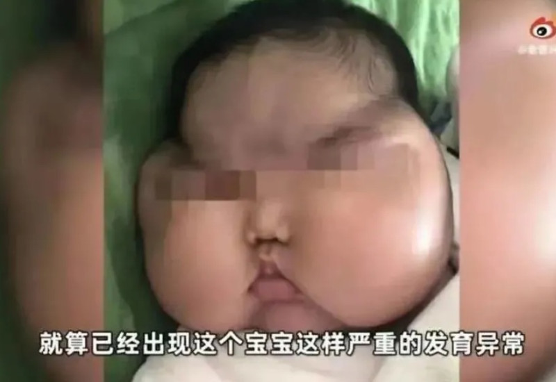 中國出現「米其林寶寶」　   圖:擷取自百度
