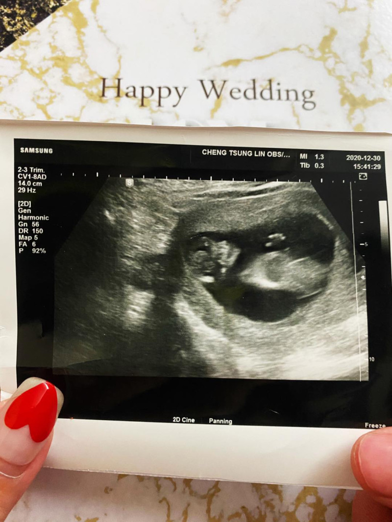 小甜甜在本月7日曬出超音波照，證實已經懷孕的好消息。    圖：翻攝自小甜甜IG