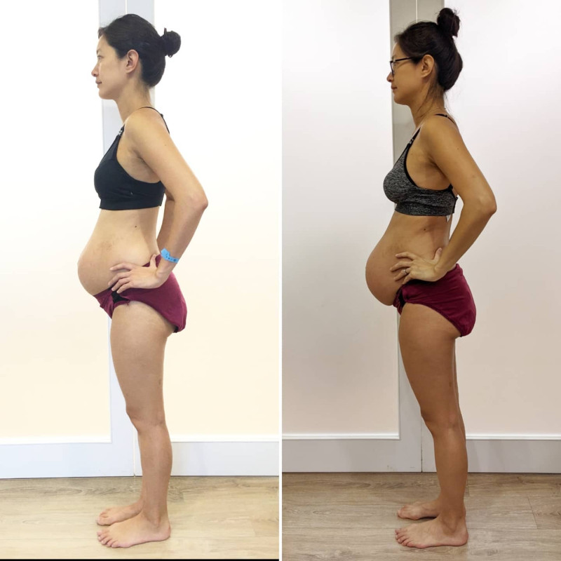 Janet比對4年前生產後（左）以及這次產後一周的身材。   圖：翻攝自Janet臉書