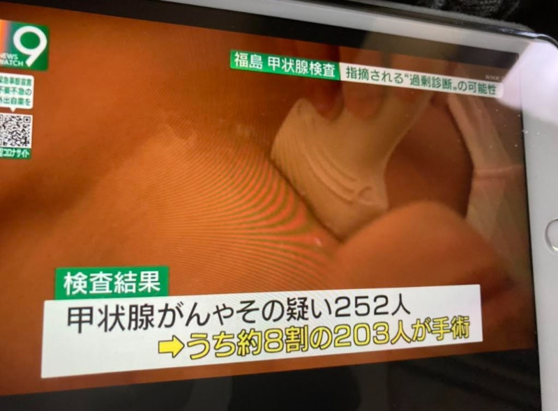 福島兒童有252人罹患甲狀腺癌，208人割除，這原本是百萬人才有二人而兒童只有1人會罹患的癌症。   圖 : 攝自NHK新聞