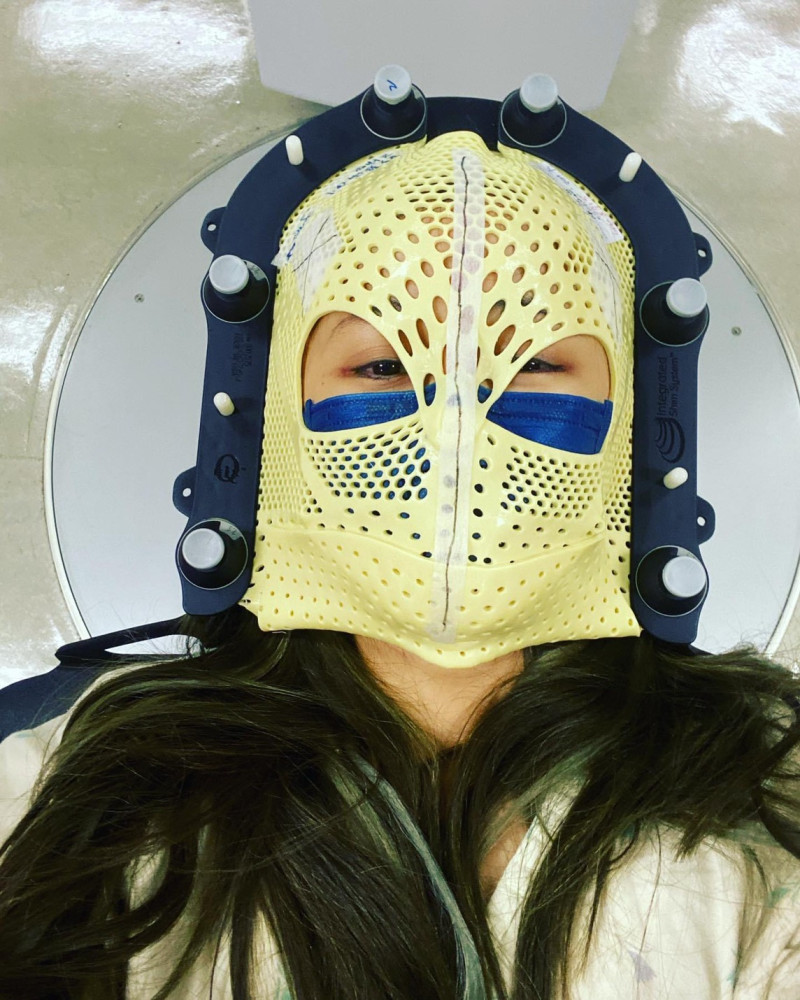 陳筱蕾曬出自己的戴上特殊塑膠面罩的照片。   圖：翻攝自臉書