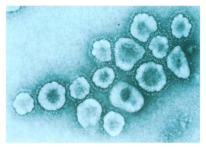 電子顯微鏡下的鼠肝炎病毒   圖：擷取自維基百科