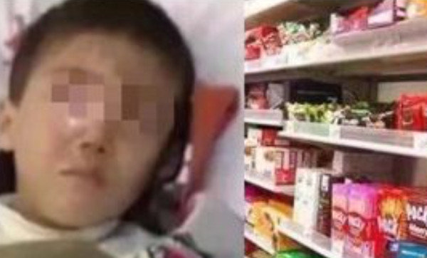 中國上海市一名男童在家吃零食時竟發生爆炸意外，造成他的右眼球「整個被溶解」。   圖：翻攝新浪新聞