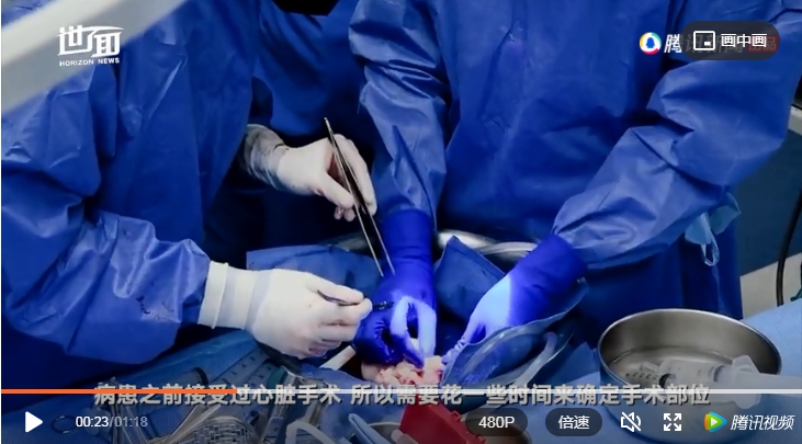 一名 57 歲的馬里蘭男子在接受轉基因豬心臟移植手術，這是人類首次成功接受轉基因豬心臟移植。   圖 : 翻攝自我們 / 騰訊