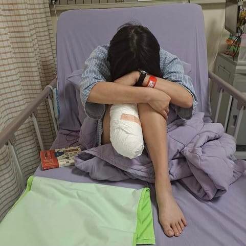 一名女作業員工作時腳被機台滾輪攪入輾壓，被迫截肢。   圖：翻攝自曾玟學臉書