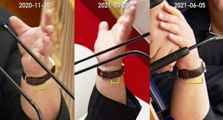 有網友在推特上指出金正恩6個月以來的身材變化，從手腕上就可看出有明顯的不同。   圖：擷取自@jeongminnkim.png推特
