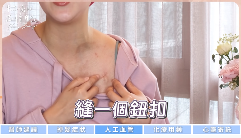 朱芯儀秀出裝在身體裡的「人工血管」。   圖：翻攝自YouTube/朱芯儀的芯情日記Chu's Diary
