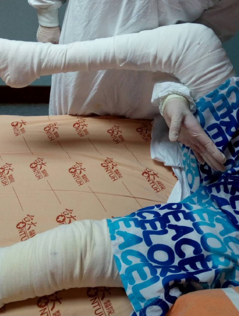 21歲的八仙塵爆傷患徐健凱，每天躺在床上努力復健，雖然腿部肌肉萎縮，父母仍盼他堅持下去，靠自己走出醫院。   圖：徐立宸提供