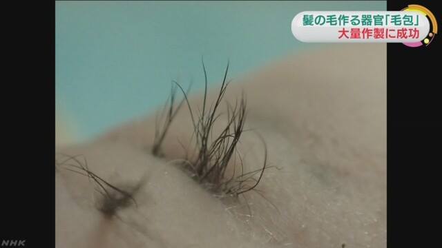 日本橫濱國立大學研究團隊史上首次成功大量培植出能夠生出毛髮的「毛囊」器官，在實驗鼠上獲得了成功。   圖：翻攝自NHK