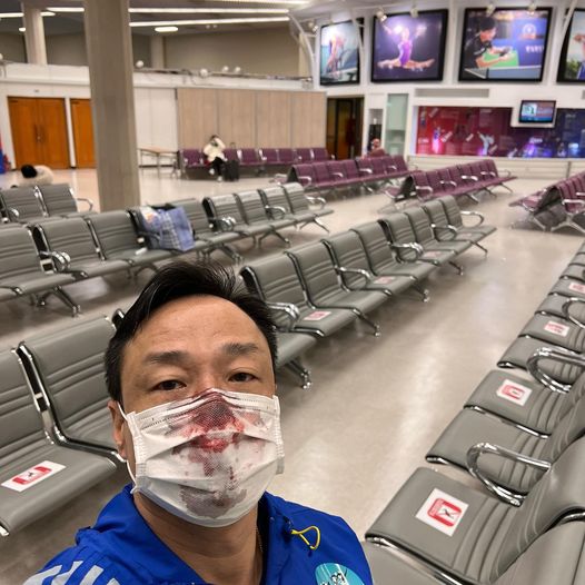 王喜入境台灣，做PCR檢測時鼻子被捅到流血。   圖：翻攝自王喜臉書