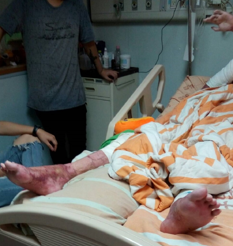 八仙塵爆傷友13日傍晚到台大醫院探視仍在住院的徐健凱，在床邊閒話家常，彼此關心。   圖：徐立宸提供