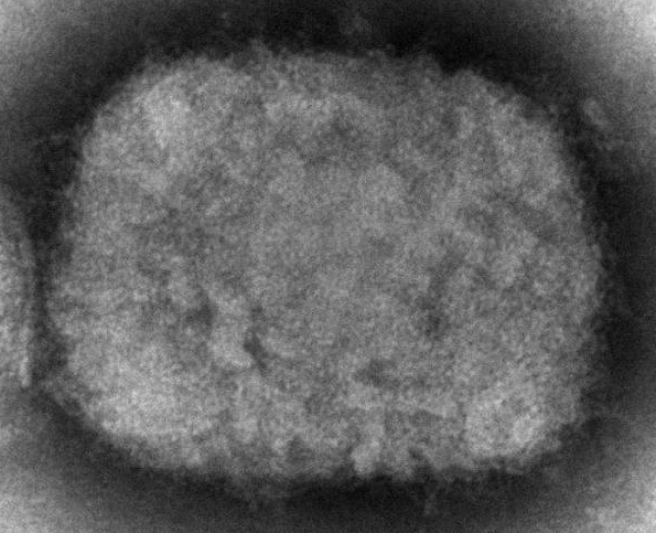 顯微鏡下的猴痘病毒。   圖 : 翻攝自環球網 (資料照)