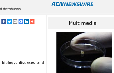新加坡國立大學醫學院腦神經醫學院研究小組發明人造微型中腦，標本只有2公分寬。   圖：翻攝ACN NEWSWIRE