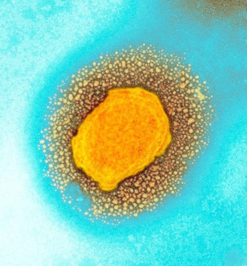 猴痘病毒的彩色透射電子顯微照片。   圖：翻攝自英國衛生安全局