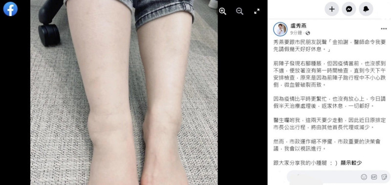 盧秀燕因腳傷請假2天。   取自盧秀燕臉書