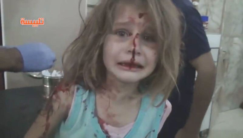 敍利亞女童阿雅滿臉血被送到醫院，不停地哭著找爸爸。   圖：翻攝You Tube