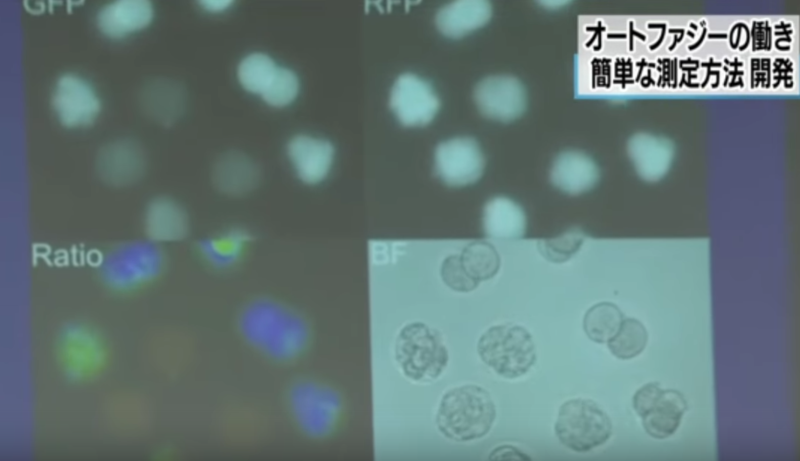 東京大學研究團隊研發出可以簡單測定細胞自噬機制的方法，可望有助於加速開發各種疾病新藥的臨床研究。   圖：翻攝自Youtube