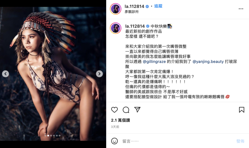 蕾拉也上傳多張美照，和粉絲分享豐唇效果。   圖：翻攝自蕾拉IG