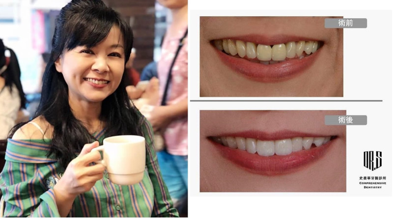 資深媒體人王時齊（左圖）在臉書大秀露齒照（右圖），表示「牙醫是不是醫生 看照片就知道 根本神醫」！   圖：翻攝自王時齊臉書/新頭殼合成