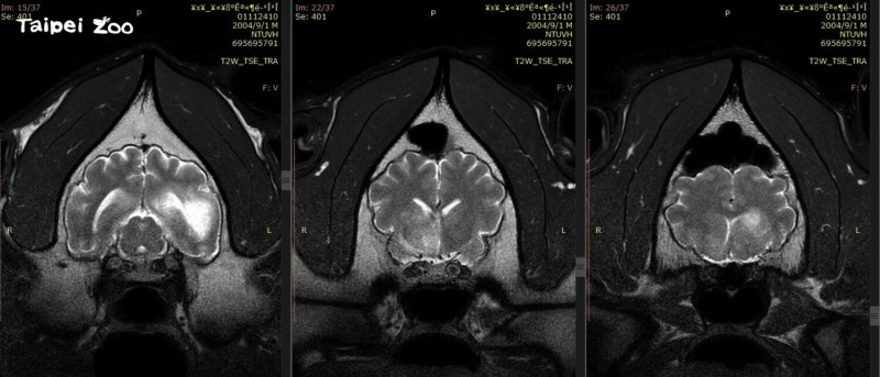 MRI影像顯示腦部病變除既有的病灶外，區域明顯擴大，且出現腫塊效應。   圖：台北市立動物園/提供
