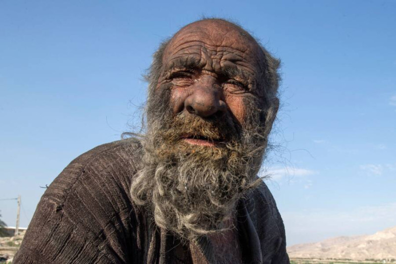 號稱「世界上最髒的人」伊朗獨居男子哈吉（Amou Haji）。   圖：翻攝自推特
