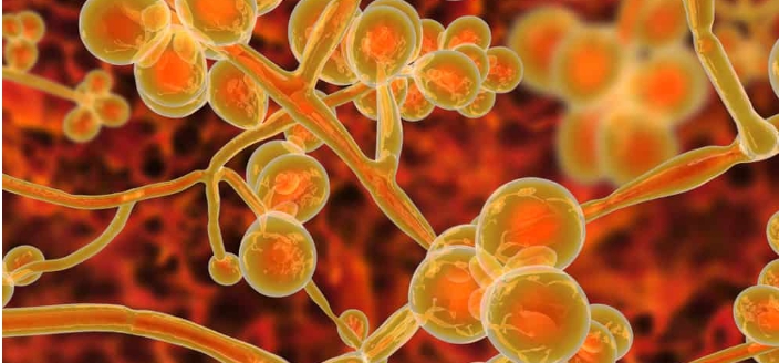 「超級真菌」（ 俗稱耳念珠菌，學名耳道假絲酵母菌 ）。   圖 : 翻攝自helloishi.com.tw