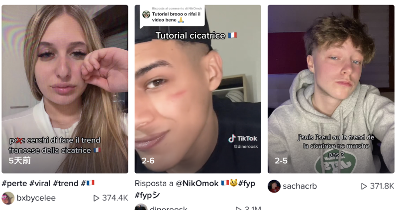 近日在法國抖音平台上掀起「捏臉挑戰」風潮，自虐行為引起關注。   圖：翻攝抖音