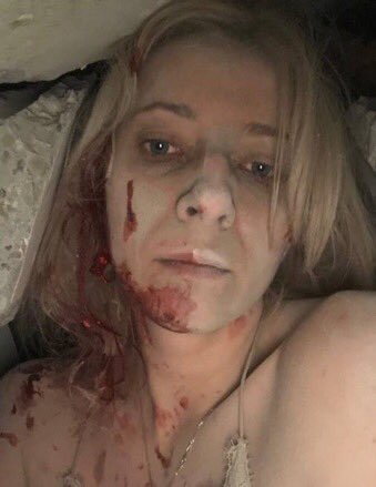 卡捷琳娜被救出時，血流滿'面。   圖：翻攝自twitter用戶「Visegrád 24」 