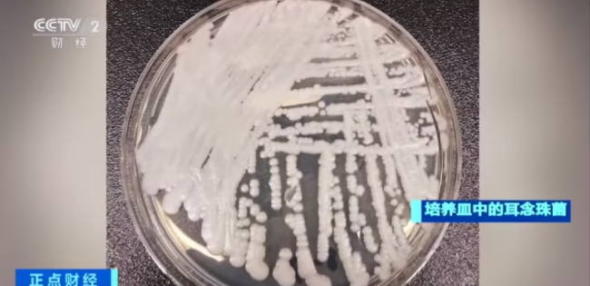培養皿中的超級真菌耳念珠菌   圖 : 翻攝自央視