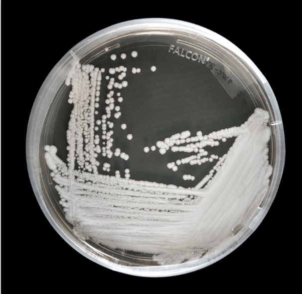 在培養皿中培養的耳念珠菌菌株。   圖：翻攝自美國疾病管制暨預防中心網站