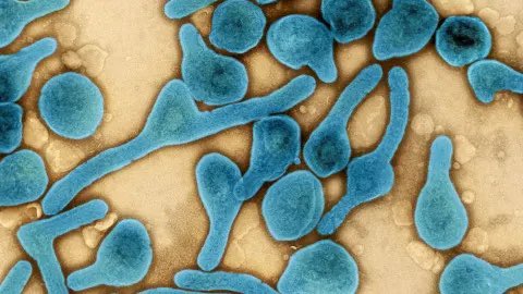 非洲國家赤道幾內亞、坦尚尼亞兩國近期爆發馬堡病毒（Marburg）疫情，累計已有21例確診病例，感染所引起之急性出血熱並導致其中14人死亡。   圖：擷取自推特@HmpxvT