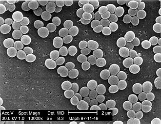 科學家發現，表皮葡萄球菌細胞會觸發產生一種名為 CD8 的免疫 T 細胞。研究人員藉由控制表皮葡萄球菌，使其產生針對特定抗原的 CD8 T 細胞，此處所指的抗原，即是與皮膚癌有關的特定抗原。(示意圖)   圖: 翻攝自維基百科