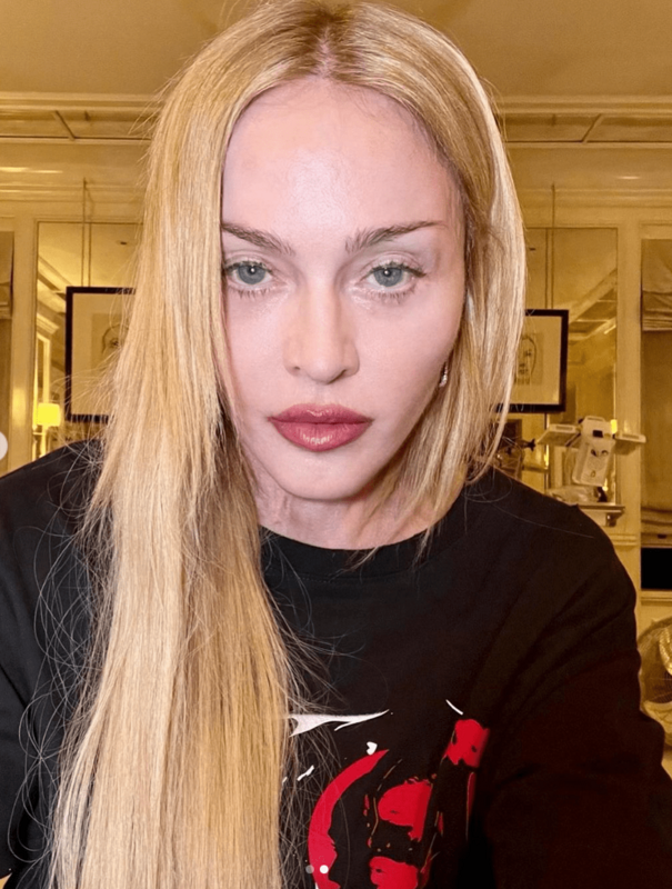 64歲的美國流行樂壇天后瑪丹娜（Madonna）上月驚傳因細菌感染住進加護病房，今日她首度曬出自拍照。   圖：翻攝自IG＠madonna