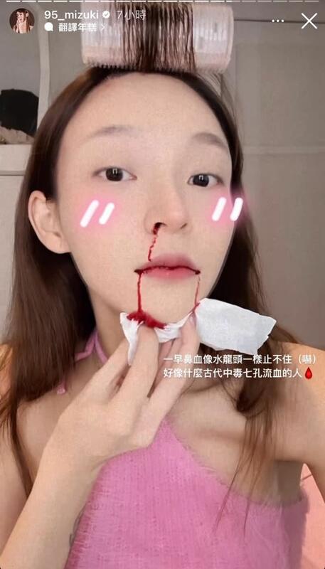 近日林襄突然曬出自己流鼻血的照片，疑似身體健康出狀況。    圖：翻攝自IG＠95_mizuki