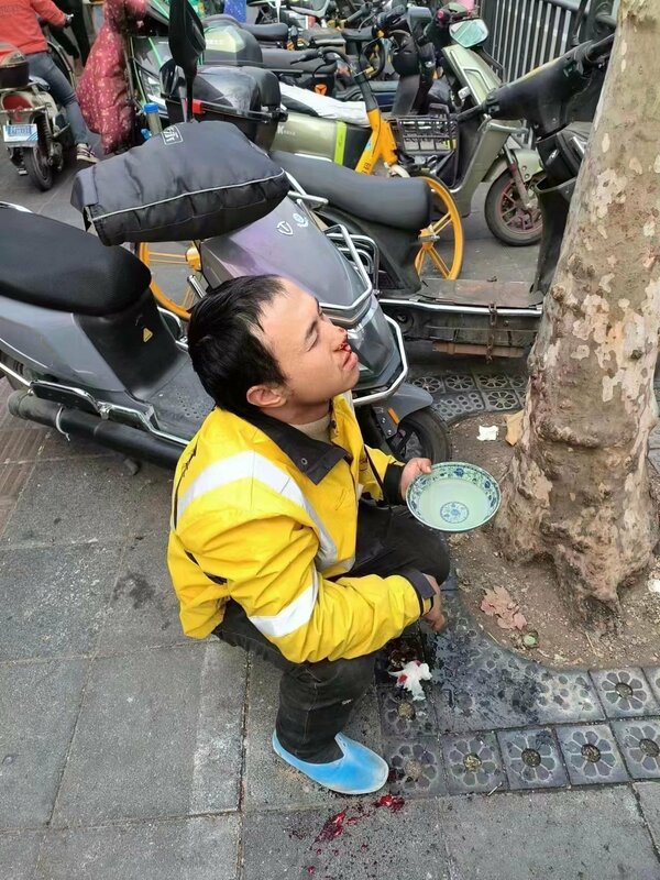 中國一名外送員因為吹噓收入過於浮誇，導致被其他感到不滿的外送員毆打致出血。   圖 : 翻攝自X帳號「越南大叔」（@ ChuTrieuViet）