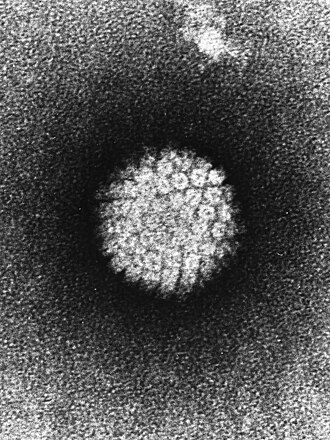 電子顯微鏡下的人類乳突病毒。   圖：翻攝自維基百科