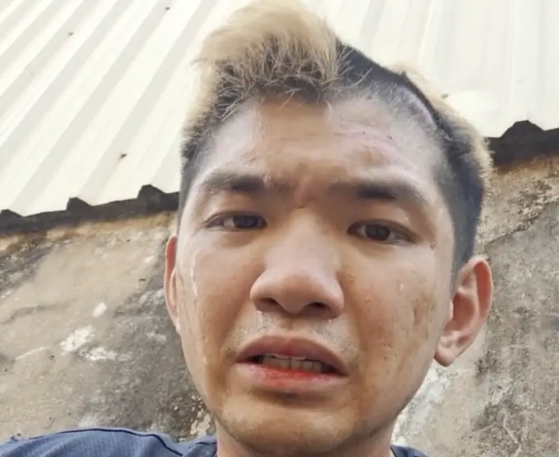 網紅「晚安小雞」過年期間直播自稱在柬埔寨「凱博園區」遭毆打、搶錢等，又自拍聲稱遭綁自逃。   圖：翻攝自「晚安小雞」臉書直播