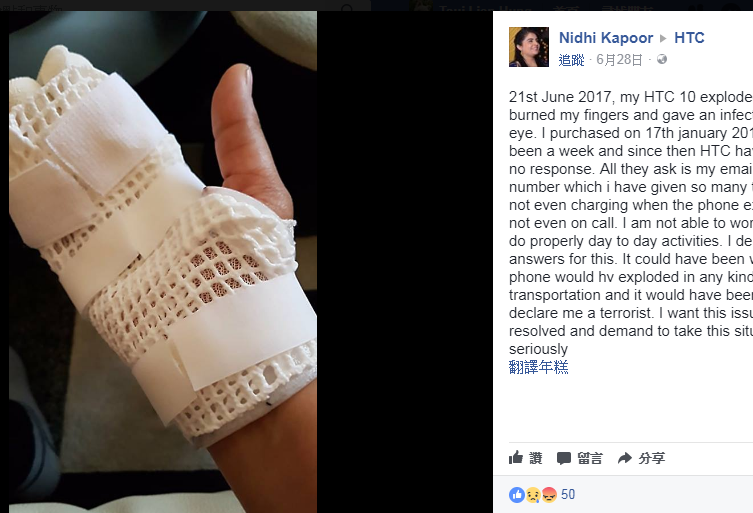 印度女子卡普爾在臉書po出自己新買的Desire 10 Pro手機爆炸，害自己無法正常生活工作的過程。   圖：翻攝卡普爾臉書